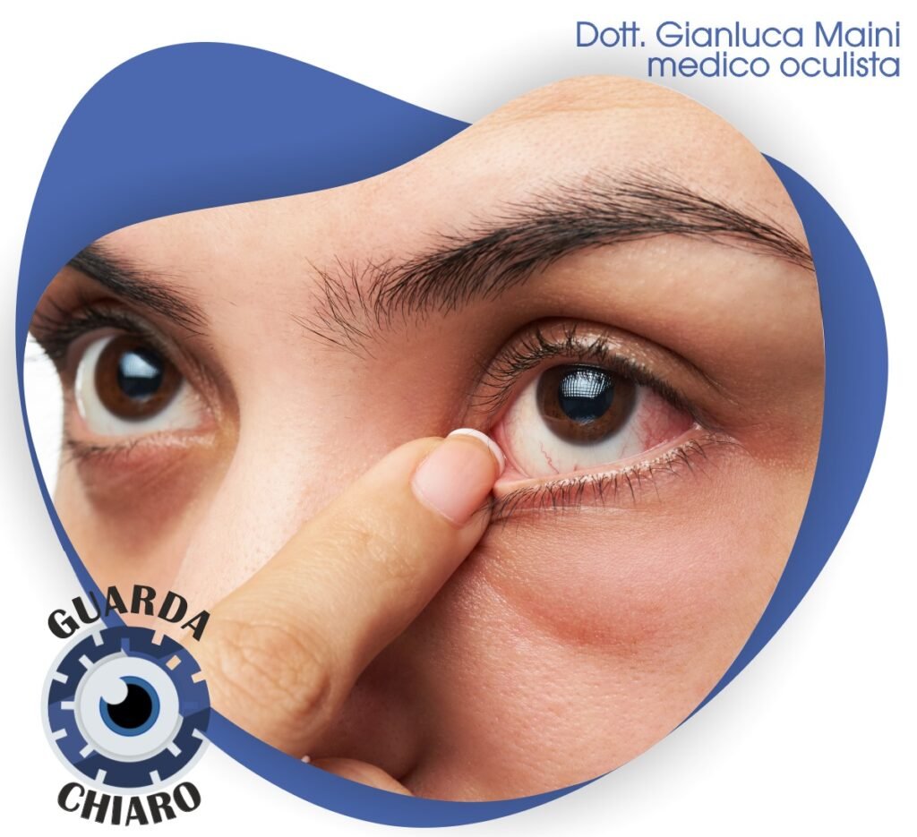 Occhio secco sintomi e prevenzione